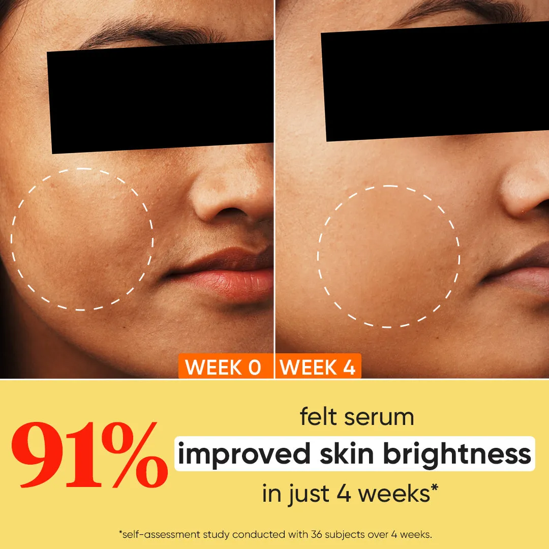 10% Vitamin C   E Face Serum with 5% Niacinamide