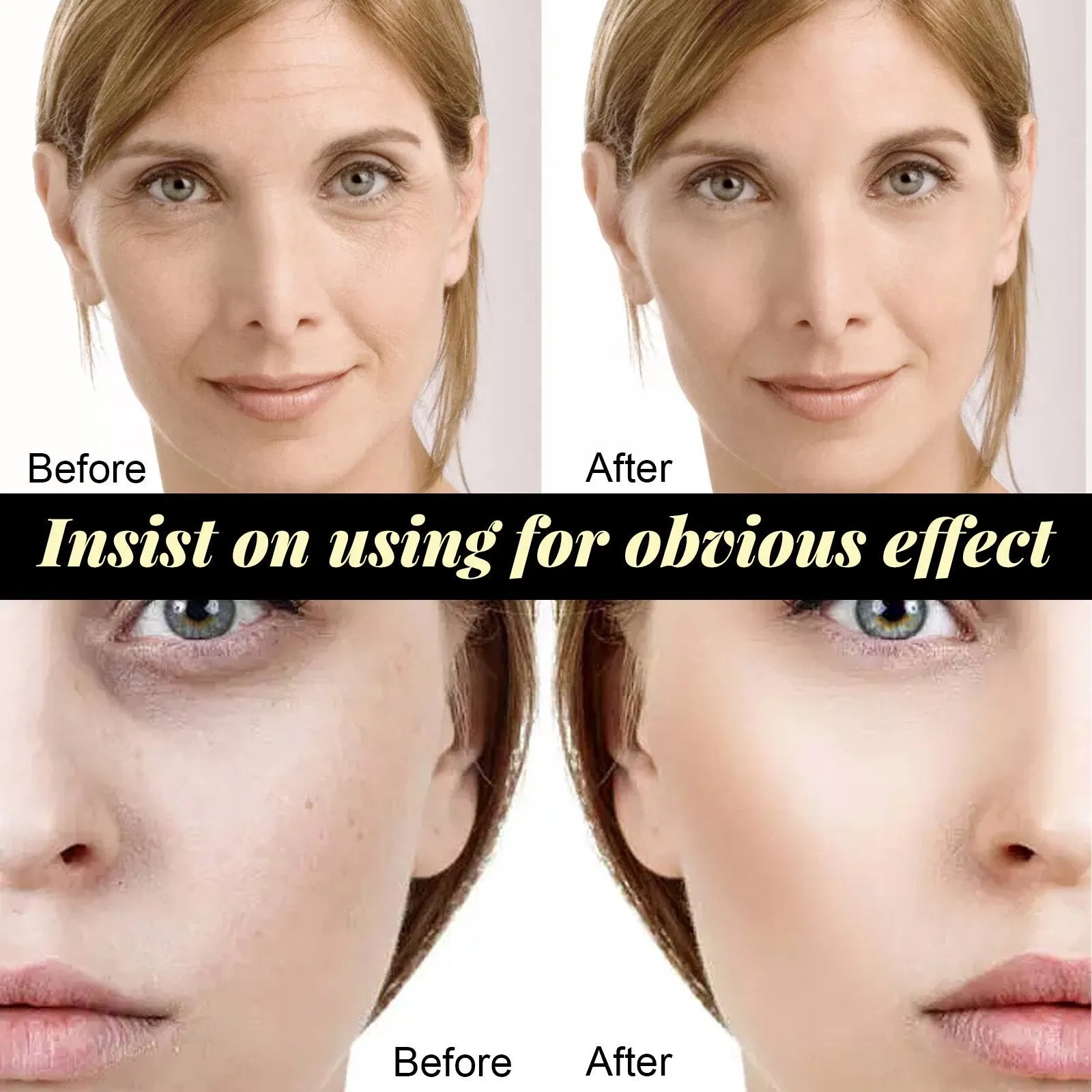 5Bags/60Pcs Protein Thread No Needle Gold Protein Line Absorbable Anti-wrinkle Face Filler Women Beauty Care Skin Collagen Based
