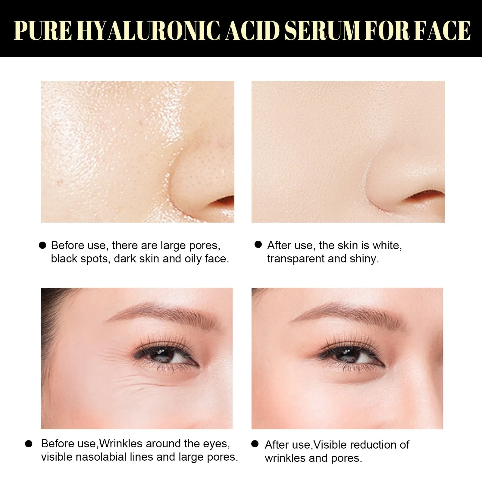 5Bags/60Pcs Protein Thread No Needle Gold Protein Line Absorbable Anti-wrinkle Face Filler Women Beauty Care Skin Collagen Based