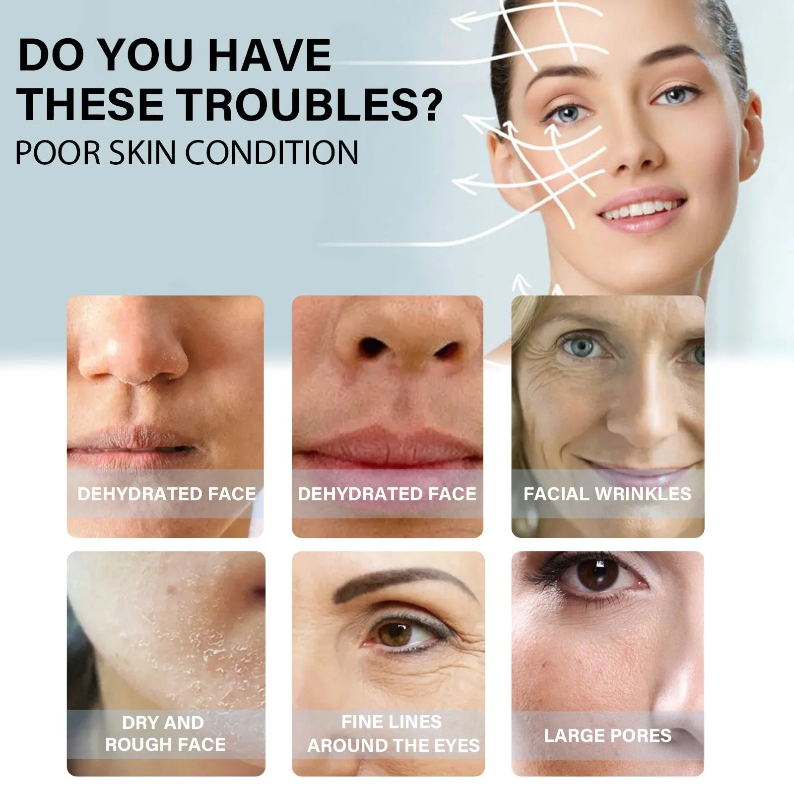 5Bags/60Pcs Protein Thread No Needle Gold Protein Line Absorbable Anti-wrinkle Face Filler Women Beauty Care Skin Collagen Based