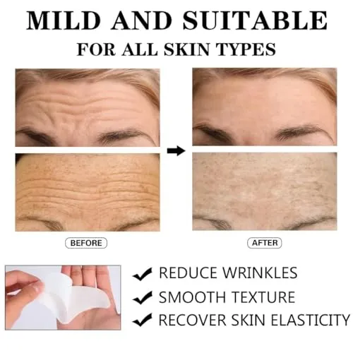 Aobeo Forehead Wrinkle Patches 12pcs - Smooth Fine Lines & Wrinkles, Anti-Wrinkle Patches with Hydrolyzed Collagen with Aloe,Vitamin E, Anti Wrinkle Patches, Forehead Wrinkles Treatment