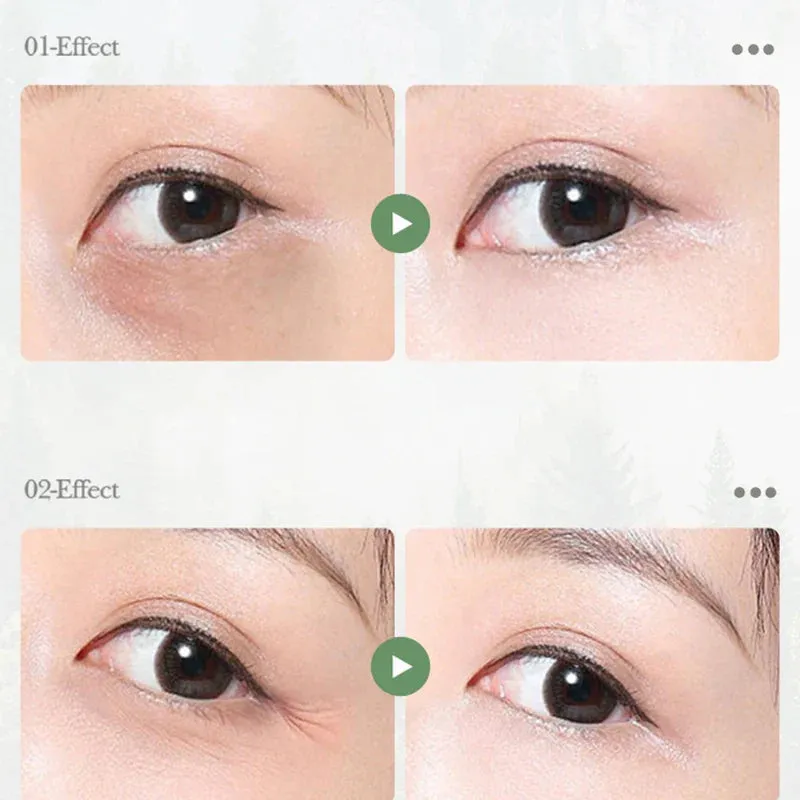 Avocado Eye Cream For Dark Circles & Puffiness