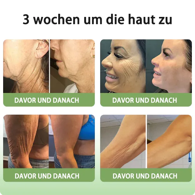 GMP-zertifiziertFurzero Anti-Aging Creme  KollagenFest fr Gesicht & Augen