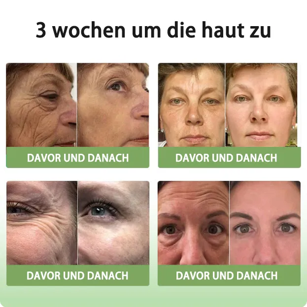 GMP-zertifiziertFurzero Anti-Aging Creme  KollagenFest fr Gesicht & Augen