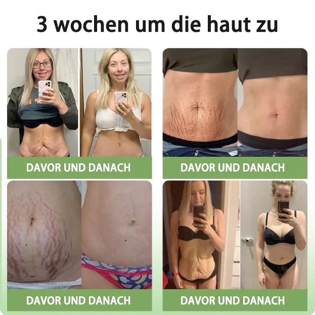 GMP-zertifiziertFurzero Anti-Aging Creme  KollagenFest fr Gesicht & Augen