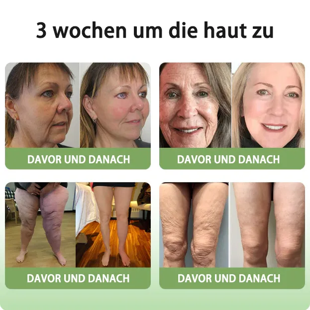 GMP-zertifiziertFurzero Anti-Aging Creme  KollagenFest fr Gesicht & Augen