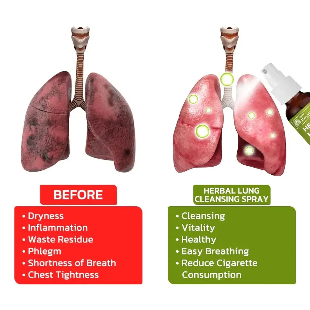 Throat Spray Lung Cleaning Herbal Body Health Ointment Care Inflammation Cleansing Cream Creams Skin Mouth Throat C0C3