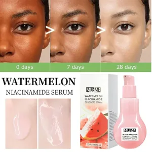Watermelon Nicotinamide Glow Essence  Brightening & Moisturizing